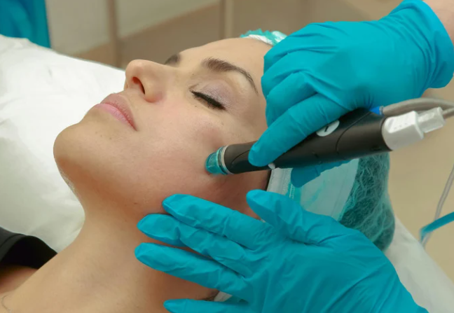 Laser Treatments